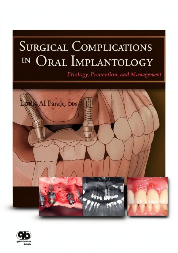 Quintessence Publishing Oral Surgery Kindle Book-0